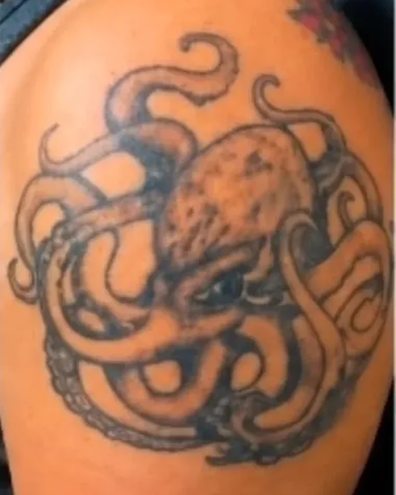 A mesma tatuagem de polvo antes da remoção